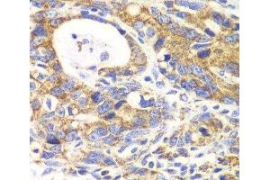 Immunohistochemistry (Paraffin-embedded Sections) (IHC (p)) image for anti-Glutamate Dehydrogenase 2 (GLUD2) antibody (ABIN7011241)