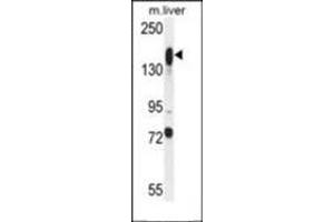 Western blot analysis in mouse liver tissue lysates (35ug/lane) using ASXL1 antibody (Center) Cat. (ASXL1 Antikörper  (AA 521-549))