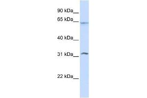 METT10D antibody used at 0. (METTL16 Antikörper  (N-Term))