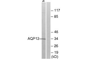 Western blot analysis of extracts from Jurkat cells, using AQP12 antibody. (Aquaporin 12A Antikörper)