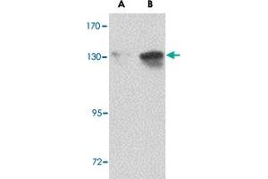 Western blot analysis of NUP155 in P815 cell lysate with NUP155 polyclonal antibody  at (A) 0.