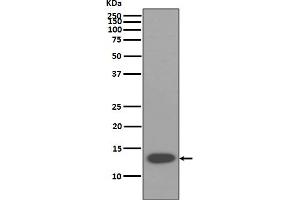 Western blot analysis of beta 2 Microglobulin expression in U937 cell lysate.