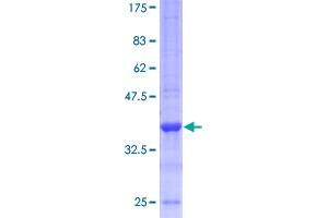 Image no. 1 for Interleukin 13 (IL13) (AA 1-132) protein (GST tag) (ABIN1307685)