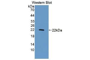 Western blot analysis of recombinant Rat GADD45a. (GADD45A Antikörper  (AA 1-165))