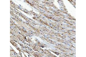 IHC analysis of NDUFS5 using anti-NDUFS5 antibody (ABIN7598943).