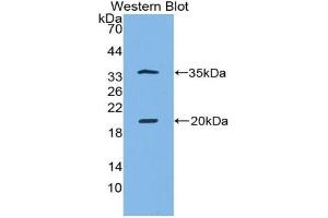 Detection of Recombinant SPINK5, Human using Polyclonal Antibody to Serine Peptidase Inhibitor Kazal Type 5 (SPINK5) (SPINK5 Antikörper  (AA 699-976))