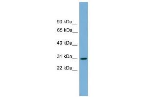 HLA-DQA2 antibody used at 1 ug/ml to detect target protein. (HLA-DQA2 Antikörper  (Middle Region))
