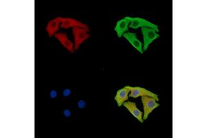 ABIN7095950 and ABIN7100012 staining Hela cells by IF/ICC. (SCYL3 Antikörper)