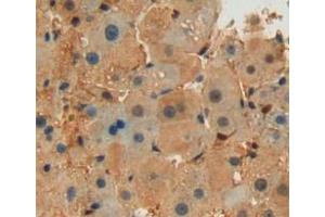 Used in DAB staining on fromalin fixed paraffin-embedded liver tissue (Septin 6 Antikörper  (AA 87-327))