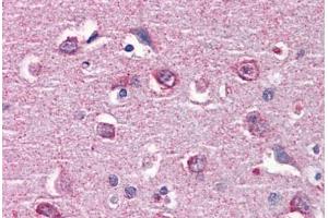 Human Brain, cortex: Formalin-Fixed, Paraffin-Embedded (FFPE) (CAMK2B Antikörper  (AA 1-504))
