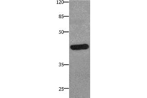 Western Blotting (WB) image for anti-Prostaglandin E Receptor 2 (Subtype EP2), 53kDa (PTGER2) antibody (ABIN2425819) (PTGER2 Antikörper)