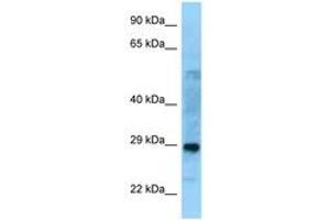 Image no. 1 for anti-Proline Synthetase Co-Transcribed (PROSC) (C-Term) antibody (ABIN6748163) (PROSC Antikörper  (C-Term))