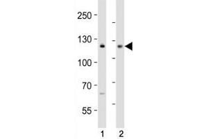 Western blot analysis of lysate from (1) MCF-7 and (2) Jurkat cell line using NOTCH antibody at 1:1000. (Notch1 Antikörper  (C-Term))