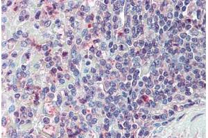 Anti-CD70 antibody  ABIN960751 IHC staining of human spleen. (CD70 Antikörper  (N-Term))