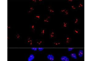 Confocal immunofluorescence analysis of U2OS cells using KRR1 Polyclonal Antibody at dilution of 1:100. (KRR1 Antikörper)