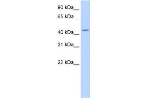 WB Suggested Anti-TRNT1 Antibody Titration:  2.