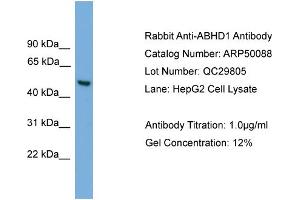 WB Suggested Anti-ABHD1  Antibody Titration: 0. (ABHD1 Antikörper  (Middle Region))