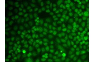 Immunofluorescence analysis of A549 cell using GADD45A antibody. (GADD45A Antikörper  (AA 1-165))