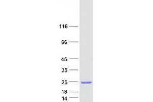 Validation with Western Blot (ARF1 Protein (Transcript Variant 1) (Myc-DYKDDDDK Tag))