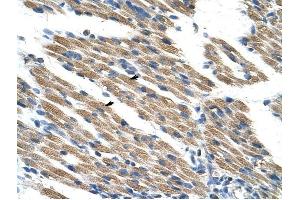 KEAP1 antibody was used for immunohistochemistry at a concentration of 4-8 ug/ml to stain Skeletal muscle cells (arrows) in Human Muscle. (KEAP1 Antikörper  (C-Term))