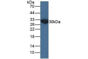 Detection of ECH1 in Human HepG2 Cells using Polyclonal Antibody to Enoyl Coenzyme A Hydratase 1, Peroxisomal (ECH1) (ECH1 Antikörper  (AA 1-328))