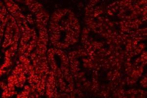IF analysis of SAP18 using anti-SAP18 antibody (ABIN7599009).