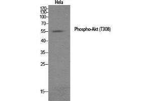 Western Blot (WB) analysis of specific cells using Phospho-Akt (T308) Polyclonal Antibody. (AKT1 Antikörper  (pThr308))