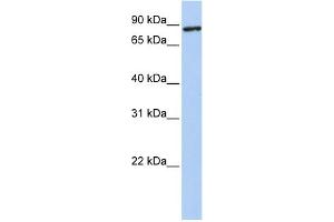 WB Suggested Anti-TMEM63A Antibody Titration:  0. (TMEM63A Antikörper  (N-Term))