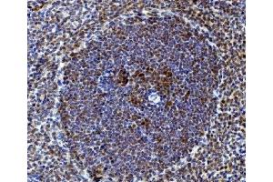 IHC analysis of Rad9/Rad9a using anti-Rad9/Rad9a antibody (ABIN7599342). (RAD9A Antikörper  (AA 1-389))