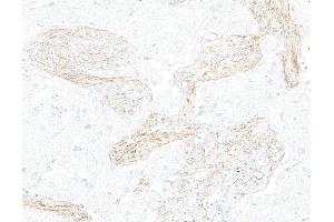 Immunohistochemistry (IHC) image for anti-Leucine Rich Repeat Containing 15 (LRRC15) (AA 22-538) antibody (ABIN7795790)