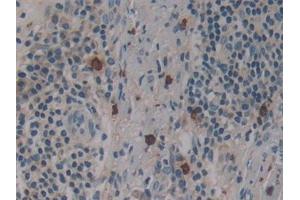 Immunohistochemistry (IHC) image for anti-Dynamin 2 (DNM2) (AA 533-731) antibody (ABIN7433204)