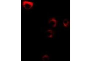 Immunofluorescent analysis of FDFT1 staining in MCF7 cells. (FDFT1 Antikörper)