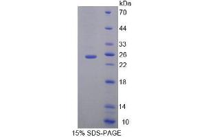 SDS-PAGE (SDS) image for Molybdenum Cofactor Synthesis 1 (MOCS1) (AA 457-636) protein (His tag) (ABIN4989414) (MOCS1 Protein (AA 457-636) (His tag))