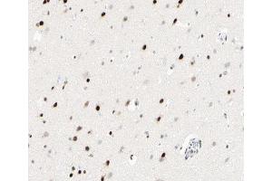 ABIN6266945 at 1/100 staining human brain tissue sections by IHC-P. (p300 Antikörper  (Internal Region))