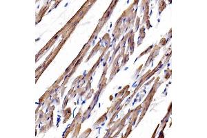 IHC analysis of heavy chain Myosin/Myh3 using anti-heavy chain Myosin/Myh3 antibody (ABIN7601735).