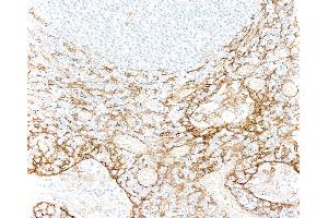 Immunohistochemistry (IHC) image for anti-Thrombomodulin (THBD) (AA 17-515) antibody (ABIN7795643) (Rekombinanter Thrombomodulin Antikörper  (AA 17-515))
