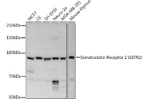 Western blot analysis of extracts of various cell lines, using Somatostatin Receptor 2 (SSTR2) antibody (ABIN3017442, ABIN3017443, ABIN3017444 and ABIN6220093) at 1:1000 dilution. (SSTR2 Antikörper  (C-Term))