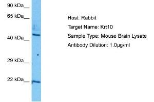 Host:  Mouse  Target Name:  KRT10  Sample Tissue:  Mouse Brain  Antibody Dilution:  1ug/ml (Keratin 10 Antikörper  (N-Term))