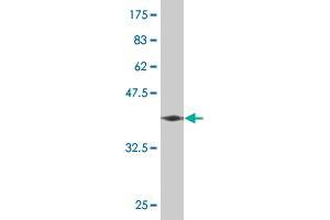 Western Blot detection against Immunogen (37. (GRIN2B Antikörper  (AA 127-236))