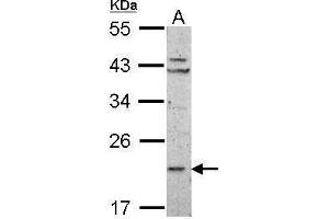 WB Image Sample (50 ug of whole cell lysate) A: mouse Liver 12% SDS PAGE antibody diluted at 1:1000 (RPL11 Antikörper)