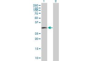 Western Blot analysis of LIF expression in transfected 293T cell line by LIF MaxPab polyclonal antibody. (LIF Antikörper  (AA 1-202))