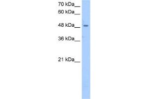 WB Suggested Anti-SSB Antibody Titration:  2. (SSB Antikörper  (Middle Region))