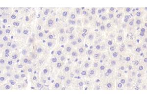 Immunohistochemistry (IHC) image for anti-Phospholipid Transfer Protein (PLTP) (AA 337-479) antibody (ABIN7440911)
