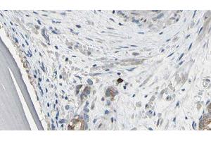 ABIN6279421 at 1/100 staining Human prostate tissue by IHC-P. (EIF3S1 Antikörper  (Internal Region))