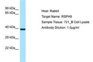 Image no. 1 for anti-Radial Spoke Head 9 Homolog (RSPH9) (AA 52-101) antibody (ABIN6749895)