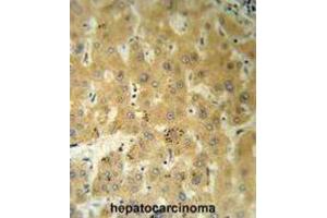 Immunohistochemistry (IHC) image for anti-Transthyretin (TTR) antibody (ABIN3002755) (TTR Antikörper)