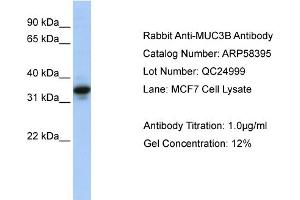 WB Suggested Anti-MUC3B  Antibody Titration: 0. (MUC3B Antikörper  (N-Term))