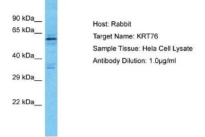 Host: Rabbit Target Name: KRT76 Sample Type: Hela Whole Cell lysates Antibody Dilution: 1.