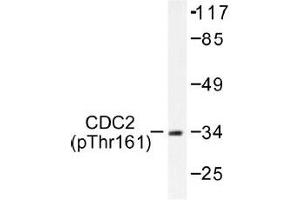 Image no. 1 for anti-Cyclin-Dependent Kinase 1 (CDK1) (pThr161) antibody (ABIN317981) (CDK1 Antikörper  (pThr161))