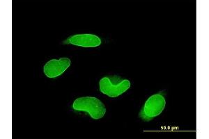 Immunofluorescence (IF) image for anti-Runt-Related Transcription Factor 1, Translocated To, 1 (Cyclin D-Related) (RUNX1T1) (AA 416-525) antibody (ABIN560190)